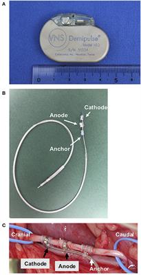 Case Report: 1-Year Follow-Up of Vagus Nerve Stimulation in a Dog With Drug-Resistant Epilepsy